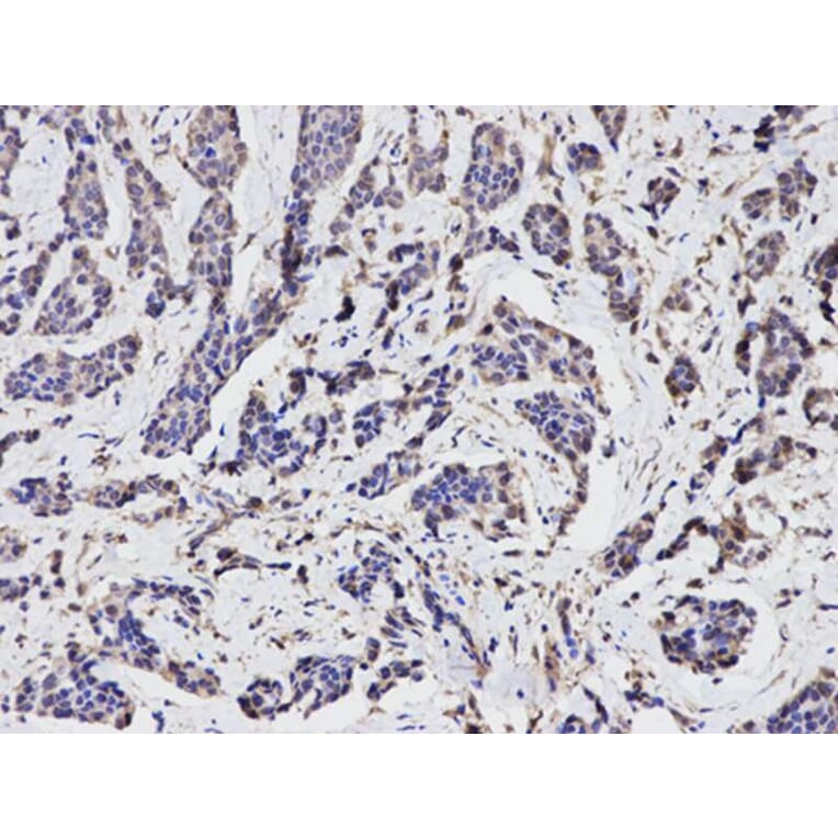 Immunohistochemistry - TGFBI Antibody from Signalway Antibody (32714) - Antibodies.com