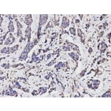 Immunohistochemistry - TGFBI Antibody from Signalway Antibody (32714) - Antibodies.com