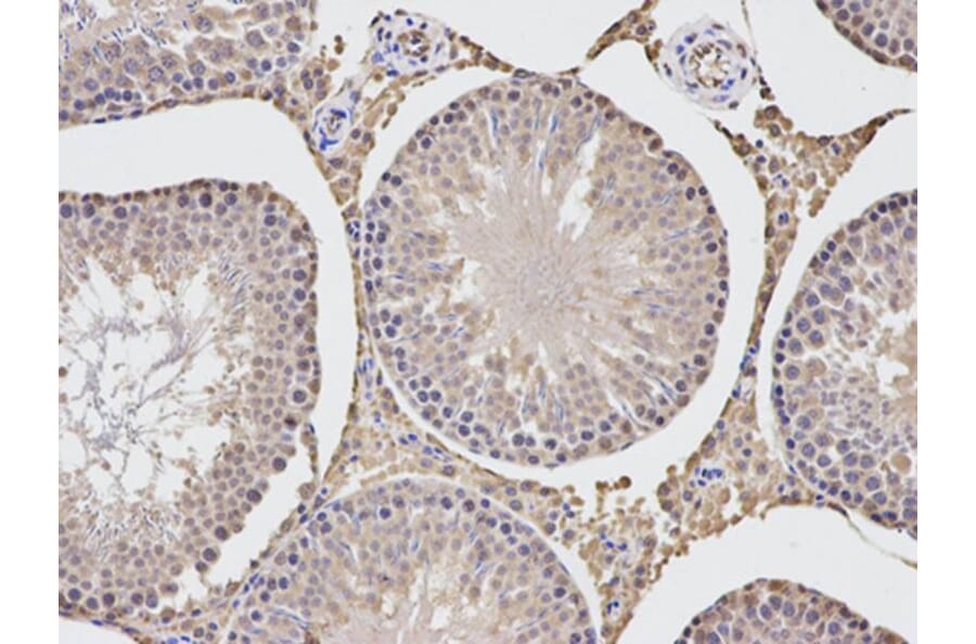 Immunohistochemistry - TGFBI Antibody from Signalway Antibody (32714) - Antibodies.com