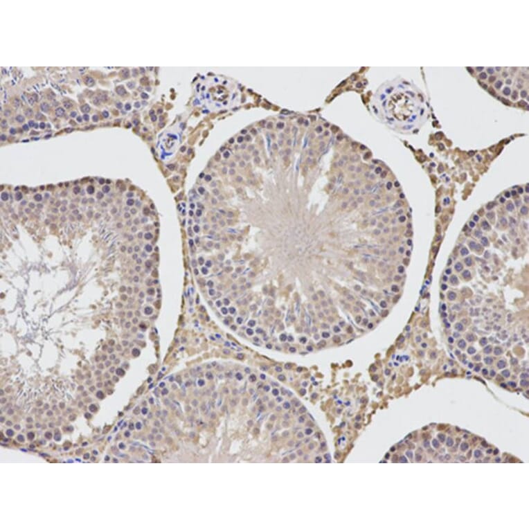 Immunohistochemistry - TGFBI Antibody from Signalway Antibody (32714) - Antibodies.com