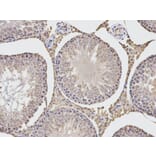 Immunohistochemistry - TGFBI Antibody from Signalway Antibody (32714) - Antibodies.com
