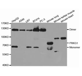 Western blot - PRKG1 Antibody from Signalway Antibody (32717) - Antibodies.com