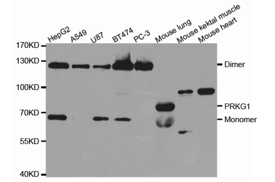 Western blot - PRKG1 Antibody from Signalway Antibody (32717) - Antibodies.com
