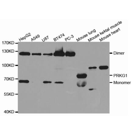 Western blot - PRKG1 Antibody from Signalway Antibody (32717) - Antibodies.com