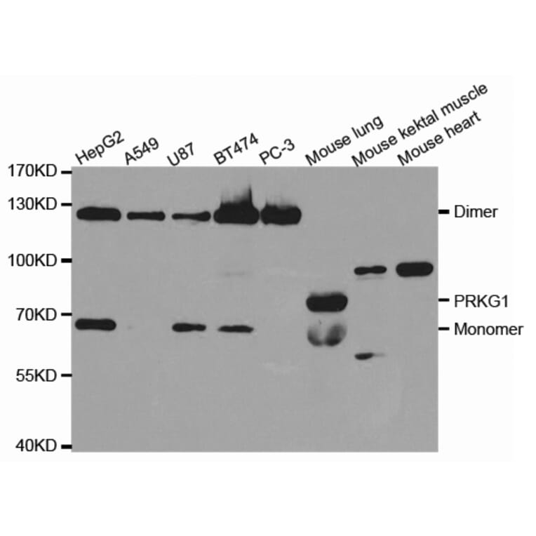 Western blot - PRKG1 Antibody from Signalway Antibody (32717) - Antibodies.com