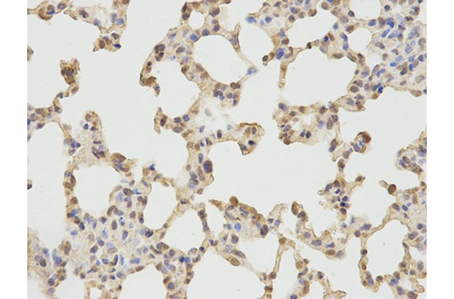 Immunohistochemistry - PRKG1 Antibody from Signalway Antibody (32717) - Antibodies.com