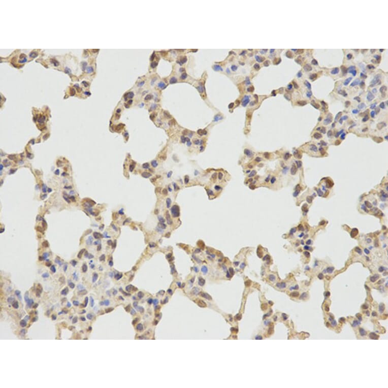 Immunohistochemistry - PRKG1 Antibody from Signalway Antibody (32717) - Antibodies.com