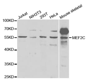 Western blot - MEF2C Antibody from Signalway Antibody (32734) - Antibodies.com