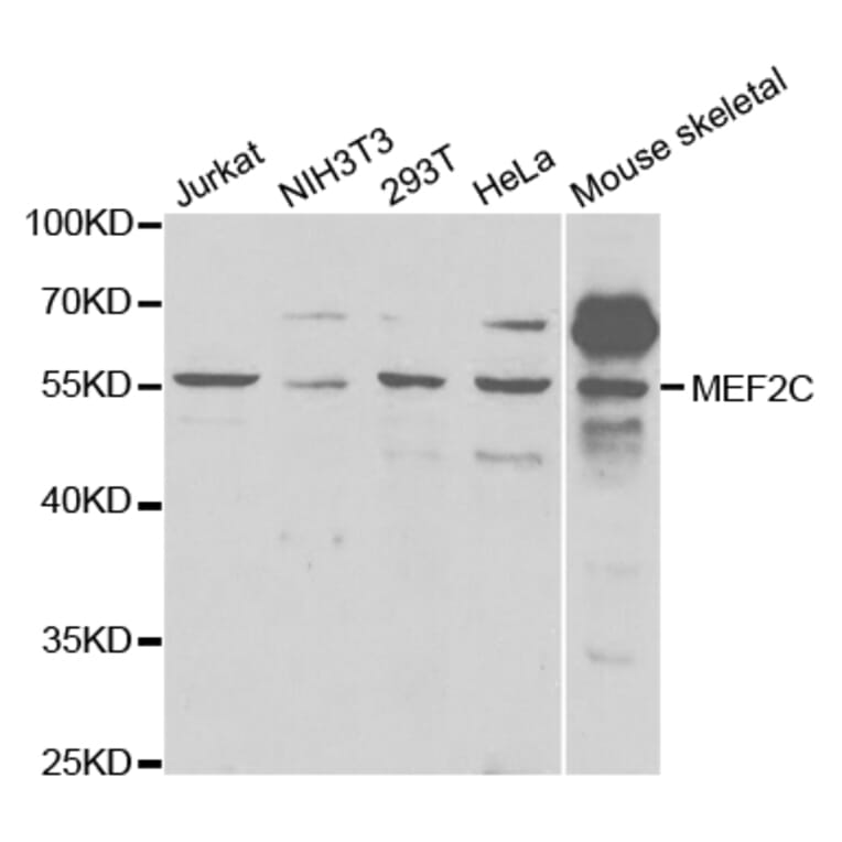 Western blot - MEF2C Antibody from Signalway Antibody (32734) - Antibodies.com