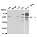 Western blot - MEF2C Antibody from Signalway Antibody (32734) - Antibodies.com