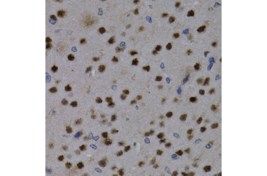 Immunohistochemistry - MEF2C Antibody from Signalway Antibody (32734) - Antibodies.com
