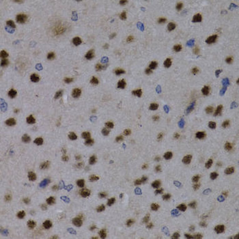 Immunohistochemistry - MEF2C Antibody from Signalway Antibody (32734) - Antibodies.com