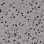 Immunohistochemistry - MEF2C Antibody from Signalway Antibody (32734) - Antibodies.com