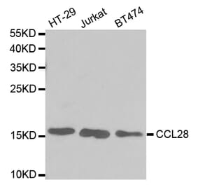Western blot - CCL28 Antibody from Signalway Antibody (32743) - Antibodies.com