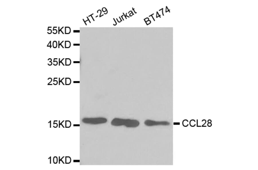 Western blot - CCL28 Antibody from Signalway Antibody (32743) - Antibodies.com