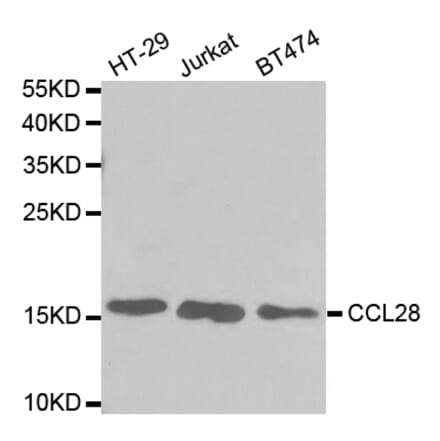Western blot - CCL28 Antibody from Signalway Antibody (32743) - Antibodies.com
