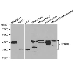 Western blot - NDRG2 Antibody from Signalway Antibody (32769) - Antibodies.com