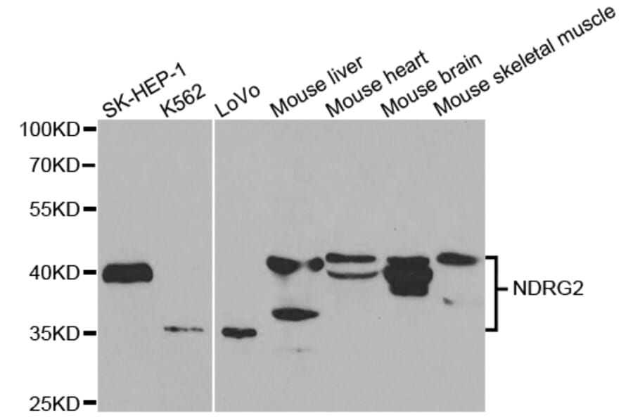 Western blot - NDRG2 Antibody from Signalway Antibody (32769) - Antibodies.com