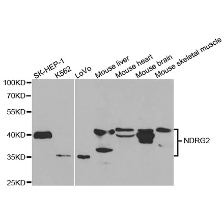 Western blot - NDRG2 Antibody from Signalway Antibody (32769) - Antibodies.com