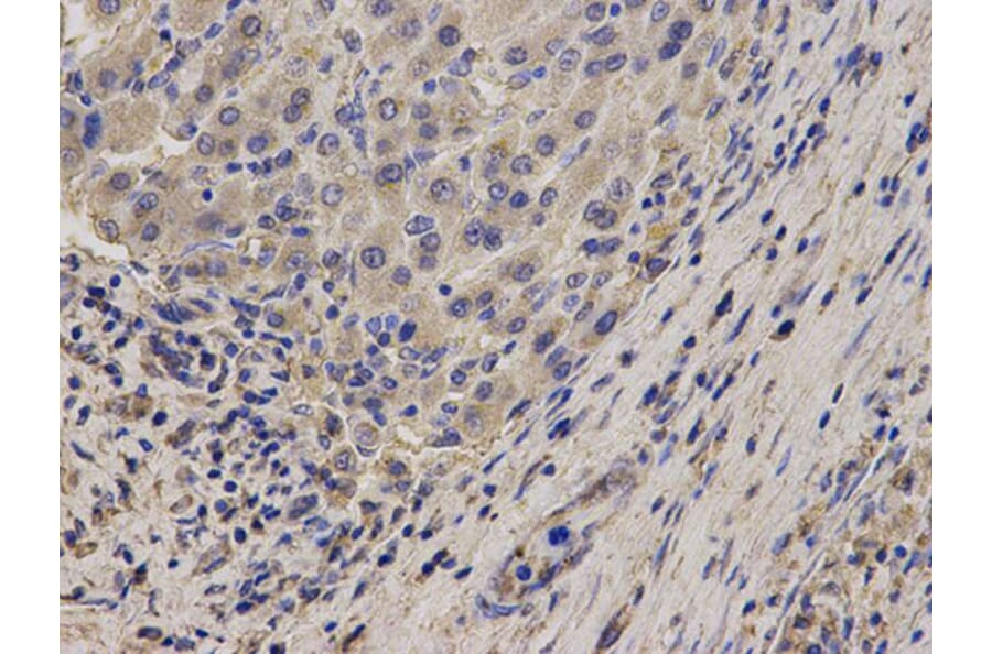 Immunohistochemistry - NDRG2 Antibody from Signalway Antibody (32769) - Antibodies.com
