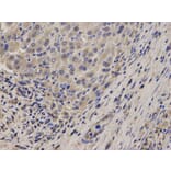 Immunohistochemistry - NDRG2 Antibody from Signalway Antibody (32769) - Antibodies.com