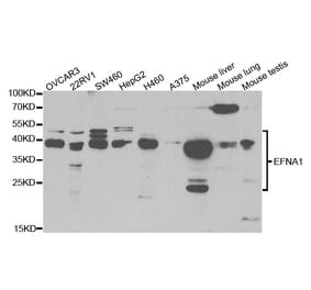 Western blot - EFNA1 Antibody from Signalway Antibody (32783) - Antibodies.com