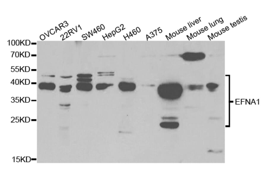 Western blot - EFNA1 Antibody from Signalway Antibody (32783) - Antibodies.com