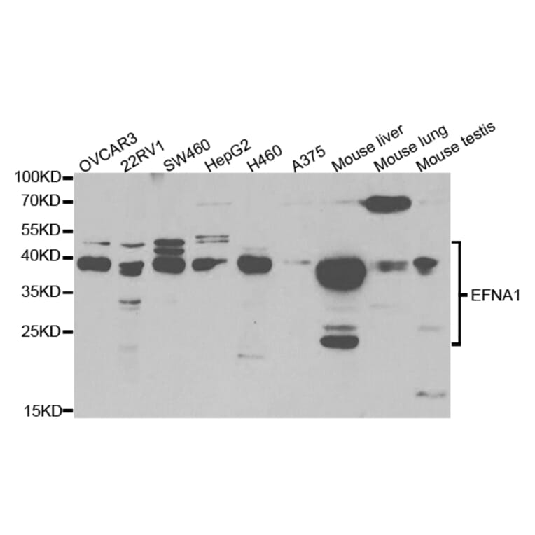 Western blot - EFNA1 Antibody from Signalway Antibody (32783) - Antibodies.com