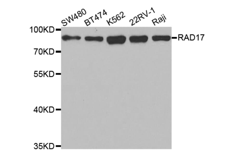 Western blot - RAD17 Antibody from Signalway Antibody (32799) - Antibodies.com