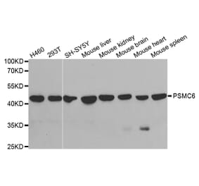 Western blot - PSMC6 Antibody from Signalway Antibody (32815) - Antibodies.com
