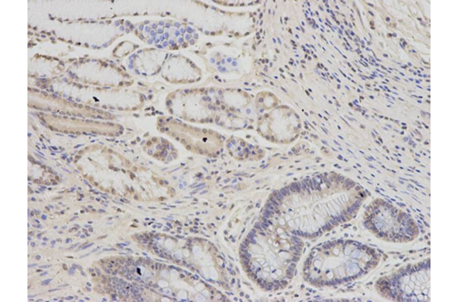Immunohistochemistry - PSMC6 Antibody from Signalway Antibody (32815) - Antibodies.com