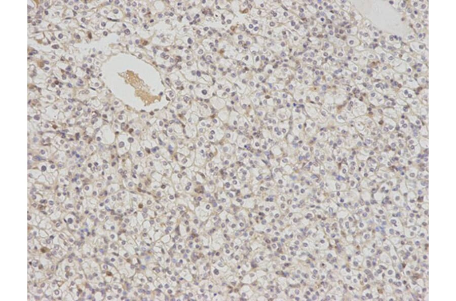 Immunohistochemistry - PSMC6 Antibody from Signalway Antibody (32815) - Antibodies.com
