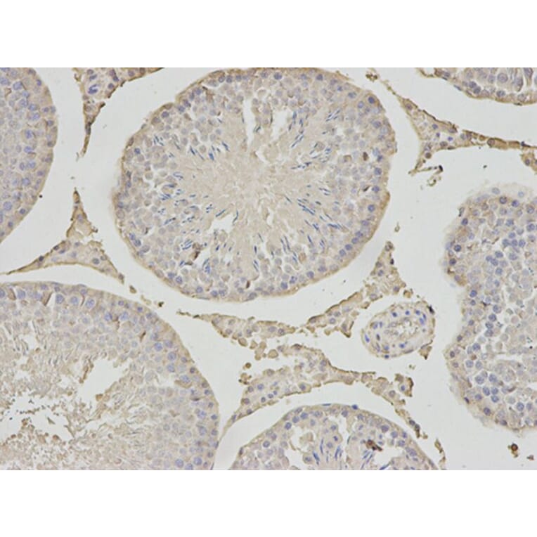 Immunohistochemistry - PSMC6 Antibody from Signalway Antibody (32815) - Antibodies.com
