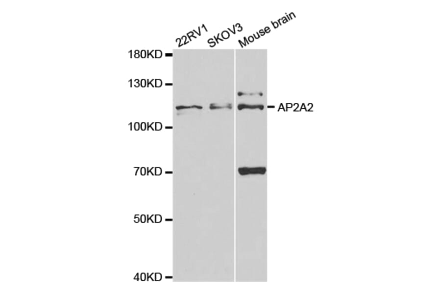 Western blot - AP2A2 Antibody from Signalway Antibody (32825) - Antibodies.com