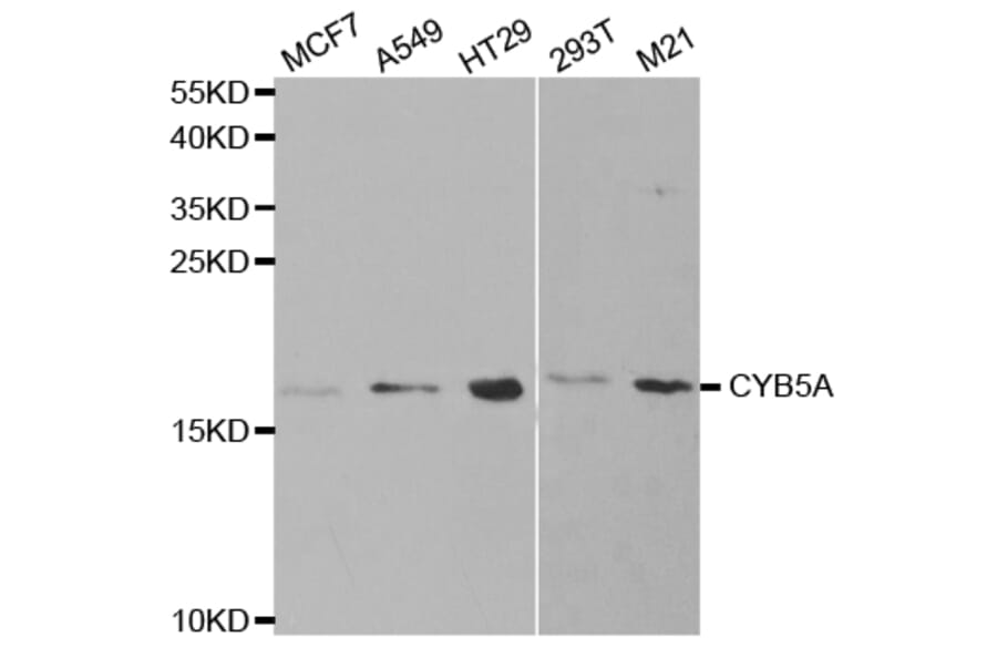Western blot - CYB5A Antibody from Signalway Antibody (32830) - Antibodies.com