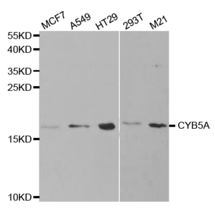 Western blot - CYB5A Antibody from Signalway Antibody (32830) - Antibodies.com