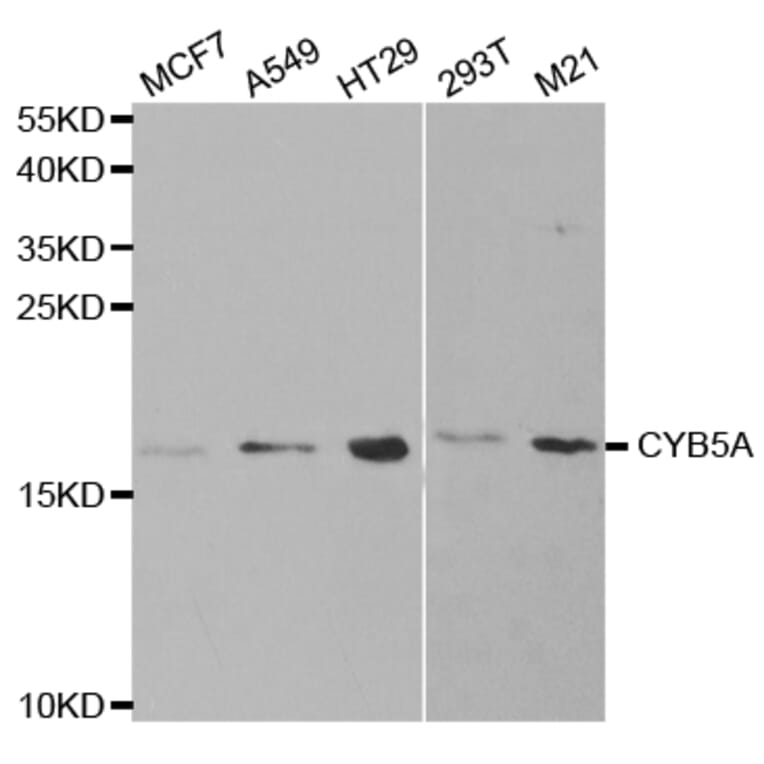 Western blot - CYB5A Antibody from Signalway Antibody (32830) - Antibodies.com