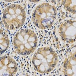 Immunohistochemistry - CYB5A Antibody from Signalway Antibody (32830) - Antibodies.com