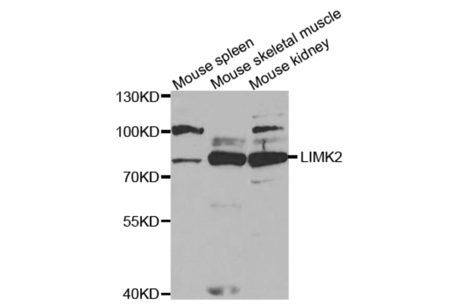 Western blot - LIMK2 Antibody from Signalway Antibody (32836) - Antibodies.com