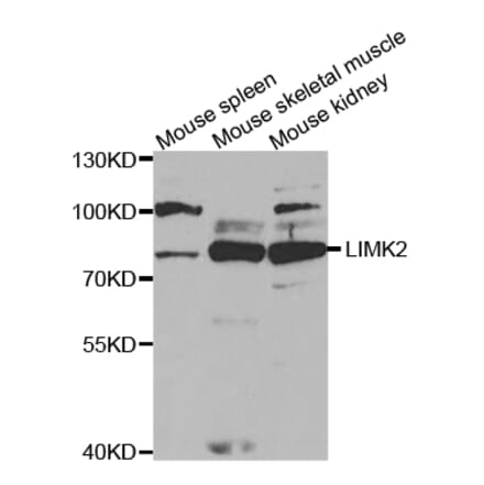 Western blot - LIMK2 Antibody from Signalway Antibody (32836) - Antibodies.com
