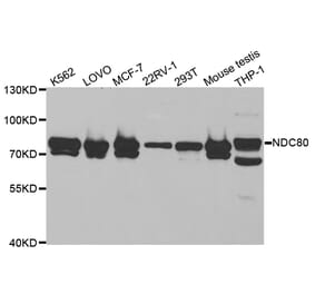 Western blot - NDC80 Antibody from Signalway Antibody (32838) - Antibodies.com
