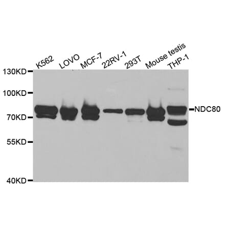 Western blot - NDC80 Antibody from Signalway Antibody (32838) - Antibodies.com