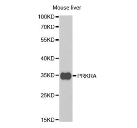 Western blot - PRKRA Antibody from Signalway Antibody (32843) - Antibodies.com