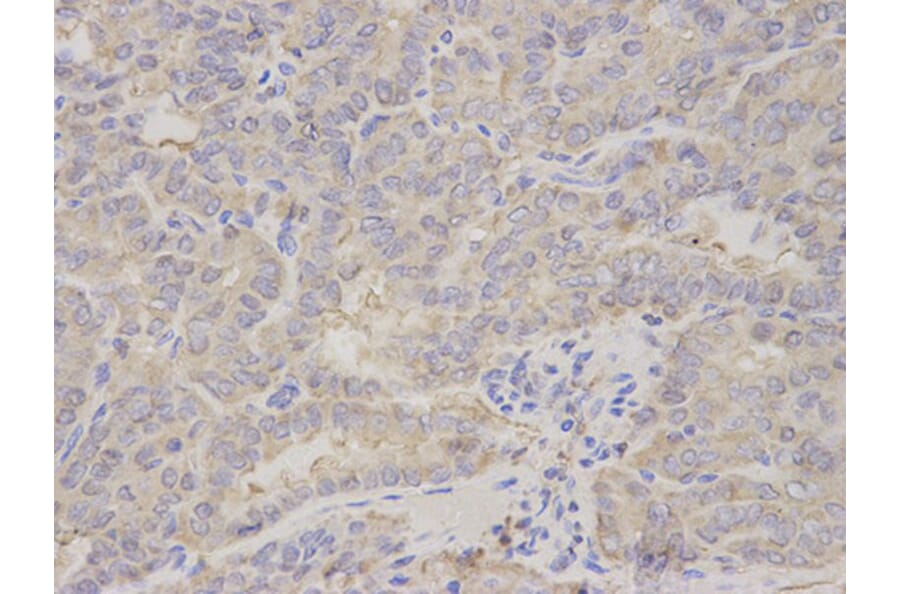 Immunohistochemistry - PRKRA Antibody from Signalway Antibody (32843) - Antibodies.com
