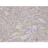 Immunohistochemistry - PRKRA Antibody from Signalway Antibody (32843) - Antibodies.com