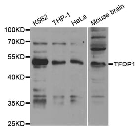 Western blot - TFDP1 Antibody from Signalway Antibody (32846) - Antibodies.com