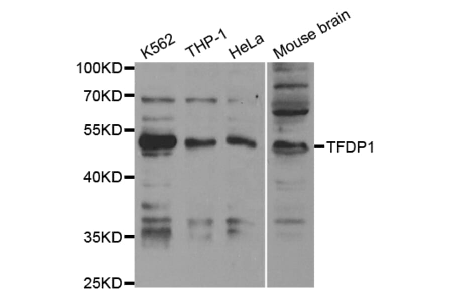 Western blot - TFDP1 Antibody from Signalway Antibody (32846) - Antibodies.com