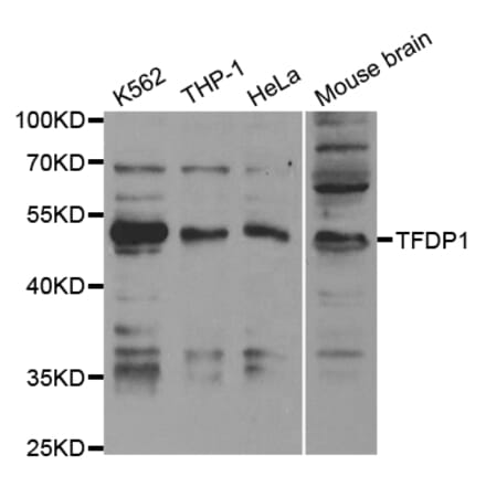 Western blot - TFDP1 Antibody from Signalway Antibody (32846) - Antibodies.com
