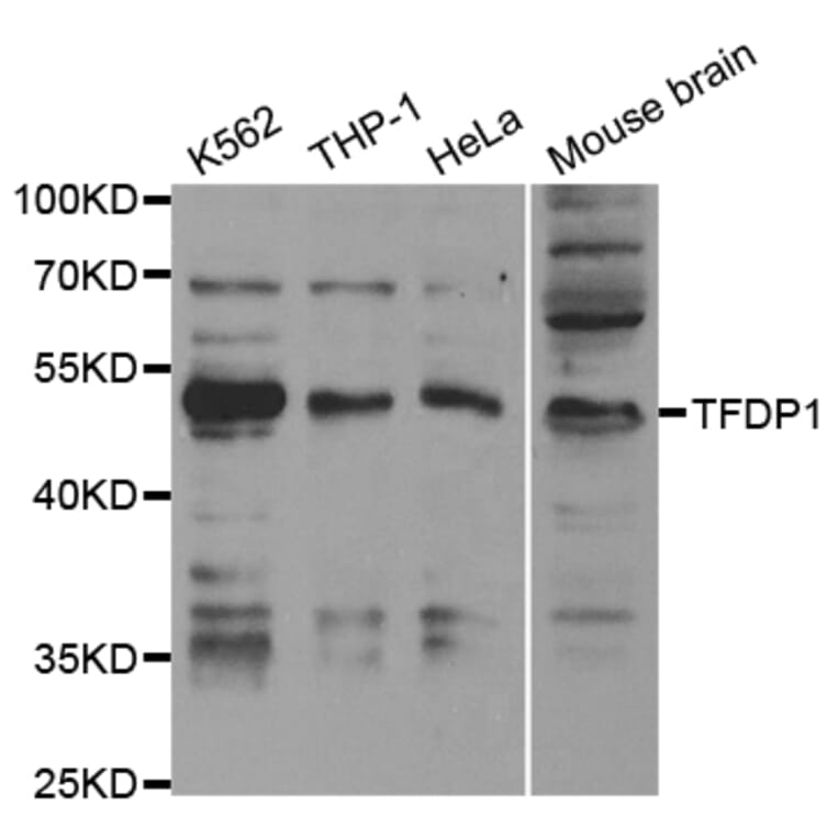 Western blot - TFDP1 Antibody from Signalway Antibody (32846) - Antibodies.com