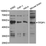 Western blot - TFDP1 Antibody from Signalway Antibody (32846) - Antibodies.com